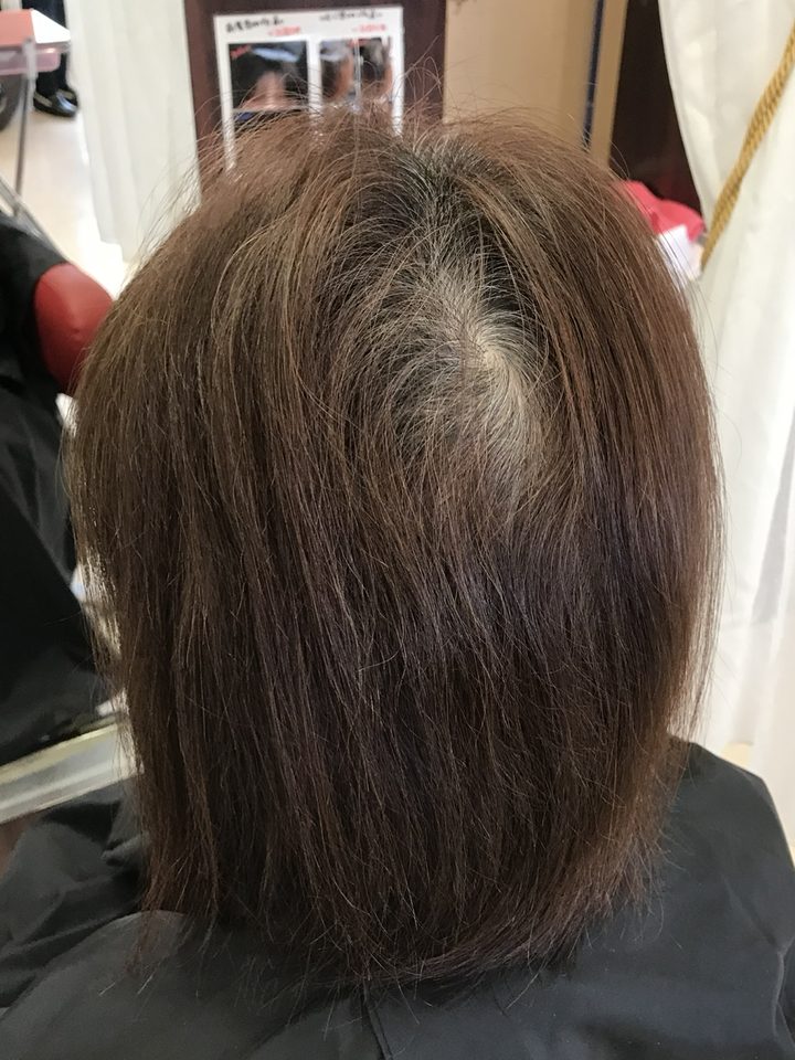 施術前の髪（後ろ姿）