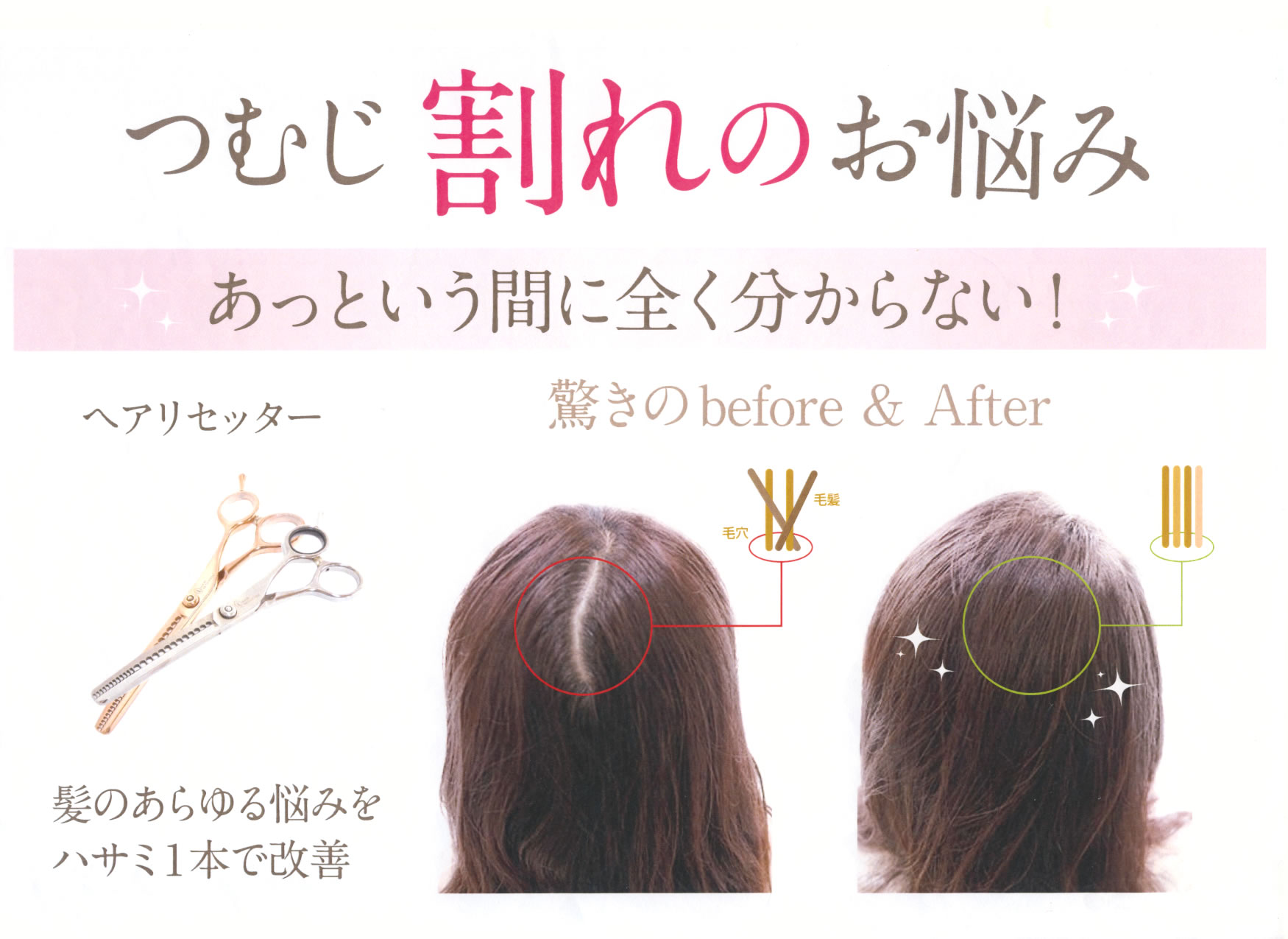 つむじ割れのお悩みとヘアリセッターの施術前後を紹介する公式画像